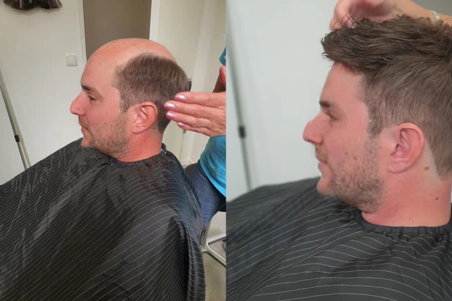 Kunde vorher und nachher mit Haarsystem